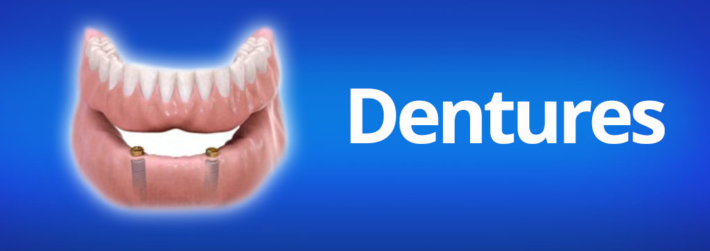 snap in implant dentures